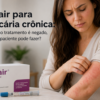 Xolair para urticária crônica: quando o tratamento é negado, o que o paciente pode fazer?