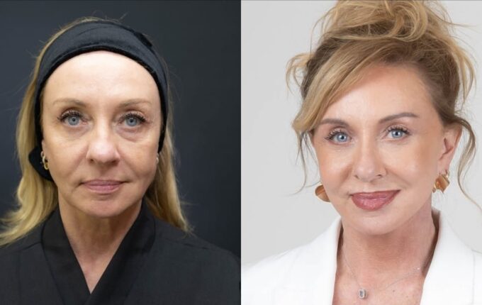 “Bem-vindos ao luxo”: facelift reforça imagem de corretora de alto padrão